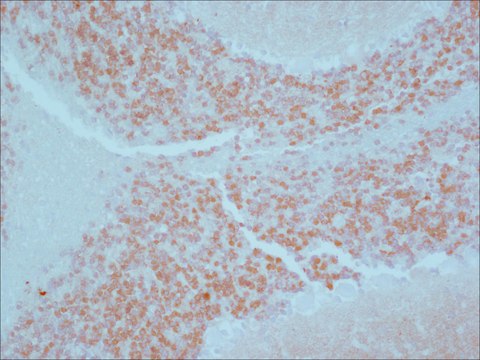 Anti-Calretinin antibody produced in rabbit affinity isolated antibody, buffered aqueous solution