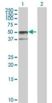 Anti-SERPINA6 antibody produced in rabbit purified immunoglobulin, buffered aqueous solution