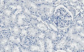 Anti-PI-3 kinase p110&#945; Antibody, clone 1J4 ZooMAb&#174; Rabbit Monoclonal recombinant, expressed in HEK 293 cells