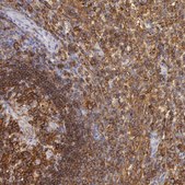 Anti-LYN antibody produced in rabbit Prestige Antibodies&#174; Powered by Atlas Antibodies, affinity isolated antibody, buffered aqueous glycerol solution