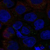Anti-SLC6A12 antibody produced in rabbit Prestige Antibodies&#174; Powered by Atlas Antibodies, affinity isolated antibody, buffered aqueous glycerol solution