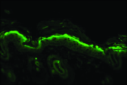 Monoclonal Anti-Nitrotyrosine antibody produced in mouse clone 39B6, 1&#160;mg/mL, purified immunoglobulin