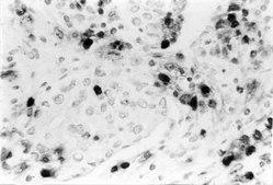 Anti-DNA Antibody, single stranded specific, clone F7-26 clone F7-26, Chemicon&#174;, from mouse