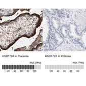 Anti-HSD17B1 antibody produced in rabbit Prestige Antibodies&#174; Powered by Atlas Antibodies, affinity isolated antibody, buffered aqueous glycerol solution