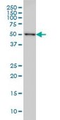 ANTI-CDK8 antibody produced in mouse clone 5H4, purified immunoglobulin, buffered aqueous solution