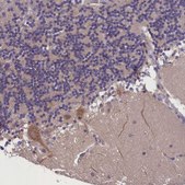 Anti-ABCC8 antibody produced in rabbit Prestige Antibodies&#174; Powered by Atlas Antibodies, affinity isolated antibody, buffered aqueous glycerol solution