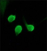 Anti-Histone Deacetylase 4 (HDAC4) (ML-19) antibody produced in rabbit affinity isolated antibody, buffered aqueous solution