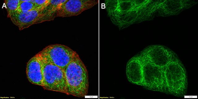 Anti-Cytokeratin 8 Antibody, clone TROMA-1 ZooMAb&#174; Rat Monoclonal recombinant, expressed in HEK 293 cells