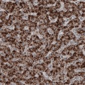 Monoclonal Anti-ACAA1 antibody produced in mouse Prestige Antibodies&#174; Powered by Atlas Antibodies, clone CL2660, purified immunoglobulin, buffered aqueous glycerol solution