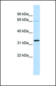 Anti-GRHL2 antibody produced in rabbit affinity isolated antibody