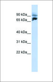 Anti-KIF2A (ab2) antibody produced in rabbit affinity isolated antibody