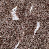 Anti-CLDN3 antibody produced in mouse Prestige Antibodies&#174; Powered by Atlas Antibodies, clone CL13129, purified by using Protein A, buffered aqueous glycerol solution