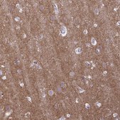 Anti-GABBR2 antibody produced in rabbit Prestige Antibodies® Powered by Atlas Antibodies, affinity isolated antibody, buffered aqueous glycerol solution