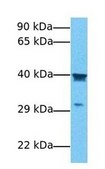 Anti-PCBP2 (AB1) antibody produced in rabbit IgG fraction of antiserum