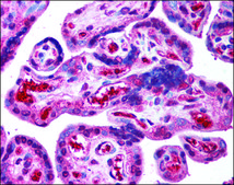 Anti-ORAI2 antibody produced in rabbit affinity isolated antibody, buffered aqueous solution
