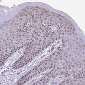 Anti-TGM3 antibody produced in rabbit Prestige Antibodies&#174; Powered by Atlas Antibodies, affinity isolated antibody, buffered aqueous glycerol solution