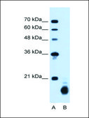 Anti-PPIB (AB2) antibody produced in rabbit IgG fraction of antiserum