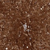 Anti-KYNU antibody produced in rabbit Prestige Antibodies&#174; Powered by Atlas Antibodies, affinity isolated antibody, buffered aqueous glycerol solution
