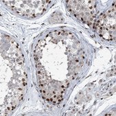 Anti-BMI1 antibody produced in rabbit Prestige Antibodies&#174; Powered by Atlas Antibodies, affinity isolated antibody, buffered aqueous glycerol solution