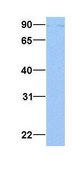 Anti-AP1G1 antibody produced in rabbit affinity isolated antibody