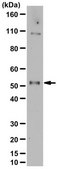 Anti-RalDH3 (ALDH1A3) from rabbit, purified by affinity chromatography