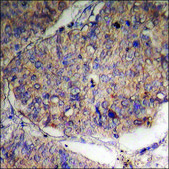 Anti-phospho-AS160 (pThr642) antibody produced in rabbit affinity isolated antibody