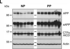 Anti-Actin Antibody, smooth muscle &#947; &amp; &#945; actin, clone CGA7 ascites fluid, clone CGA7, Chemicon&#174;