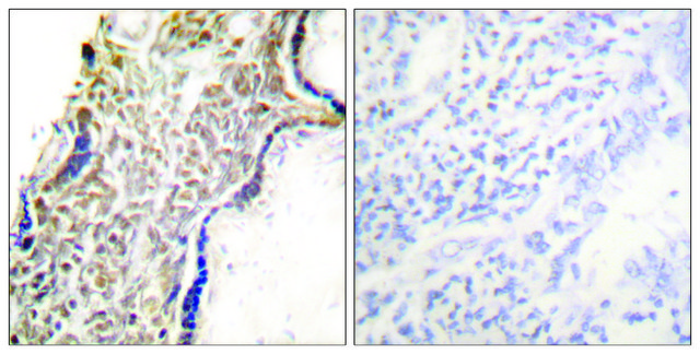 Anti-p14 ARF antibody produced in rabbit affinity isolated antibody