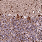 Anti-PHLDB1 antibody produced in rabbit Prestige Antibodies&#174; Powered by Atlas Antibodies, affinity isolated antibody, buffered aqueous glycerol solution