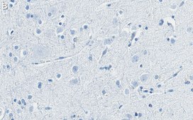Anti-Substance P Antibody, clone 1K3 ZooMAb® Rabbit Monoclonal recombinant, expressed in HEK 293 cells