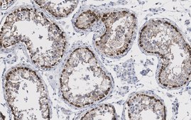 Anti-Ac-α-Tubulin (Lys40) Antibody, clone 1L10, ZooMAb® Rabbit Monoclonal recombinant, expressed in HEK 293 cells