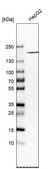 Anti-A2M antibody produced in rabbit Prestige Antibodies&#174; Powered by Atlas Antibodies, affinity isolated antibody, buffered aqueous glycerol solution