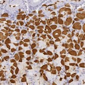 Anti-CKB antibody produced in rabbit Prestige Antibodies&#174; Powered by Atlas Antibodies, affinity isolated antibody, buffered aqueous glycerol solution
