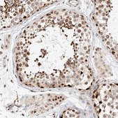 Anti-HDAC9 antibody produced in rabbit Prestige Antibodies® Powered by Atlas Antibodies, affinity isolated antibody, buffered aqueous glycerol solution
