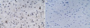 Anti-Doublecortin Antibody serum, from guinea pig