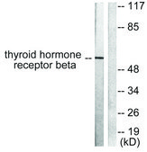 Anti-Thyroid Hormone Receptor &#946;, N-Terminal antibody produced in rabbit affinity isolated antibody