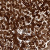 Anti-CRP antibody produced in rabbit Prestige Antibodies&#174; Powered by Atlas Antibodies, affinity isolated antibody, buffered aqueous glycerol solution, Ab2