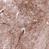 Anti-MCAM antibody produced in mouse Prestige Antibodies&#174; Powered by Atlas Antibodies, clone CL12855, purified by using Protein A, buffered aqueous glycerol solution