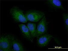 Monoclonal Anti-VIM antibody produced in mouse clone 3E9, purified immunoglobulin, buffered aqueous solution