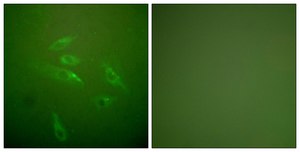 Anti-Collagen III antibody produced in rabbit affinity isolated antibody