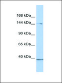 Anti-RB1CC1 antibody produced in rabbit affinity isolated antibody