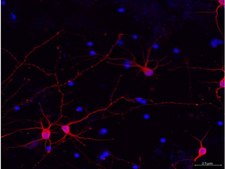 Milli-Mark&#174; Pan Neuronal Marker Milli-Mark Pan Neuronal Marker is an antibody targeting the Pan Neuronal Marker protein, validated for use in ICC, IHC, IF &amp; IHC.