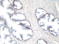 Anti-p40 (deltaNp63) Rabbit Monoclonal Antibody clone RM392, affinity purified immunoglobulin
