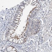 Anti-CEP164 antibody produced in rabbit Prestige Antibodies&#174; Powered by Atlas Antibodies, affinity isolated antibody, buffered aqueous glycerol solution