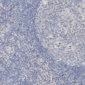 Anti-DNAH5 antibody produced in rabbit Prestige Antibodies&#174; Powered by Atlas Antibodies, affinity isolated antibody, buffered aqueous glycerol solution