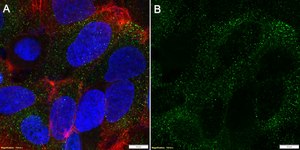 Anti-RAGE Antibody, clone 1I22 ZooMAb&#174; Rabbit Monoclonal recombinant, expressed in HEK 293 cells