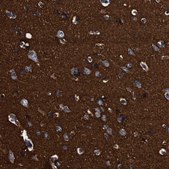 Anti-GAP43 antibody produced in rabbit Prestige Antibodies&#174; Powered by Atlas Antibodies, affinity isolated antibody, buffered aqueous glycerol solution