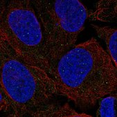 Anti-FANCL antibody produced in rabbit Prestige Antibodies&#174; Powered by Atlas Antibodies, affinity isolated antibody, buffered aqueous glycerol solution