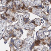 Anti-MMP16 antibody produced in rabbit Prestige Antibodies&#174; Powered by Atlas Antibodies, affinity isolated antibody, buffered aqueous glycerol solution