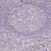 Anti-ACVR1B antibody produced in rabbit Prestige Antibodies&#174; Powered by Atlas Antibodies, affinity isolated antibody, buffered aqueous glycerol solution